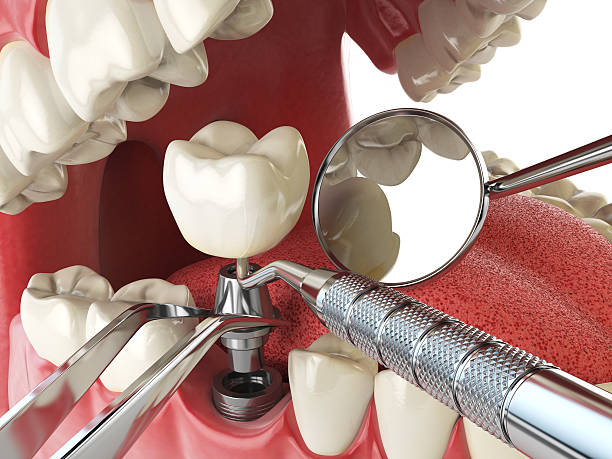 Best Emergency Broken Tooth Repair in Walkersville, MD