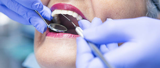 Best Emergency Tooth Extraction in Walkersville, MD